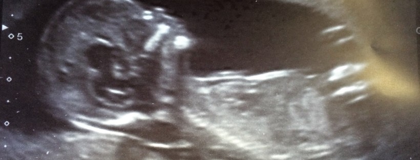 Aurelia's scan at 13 weeks